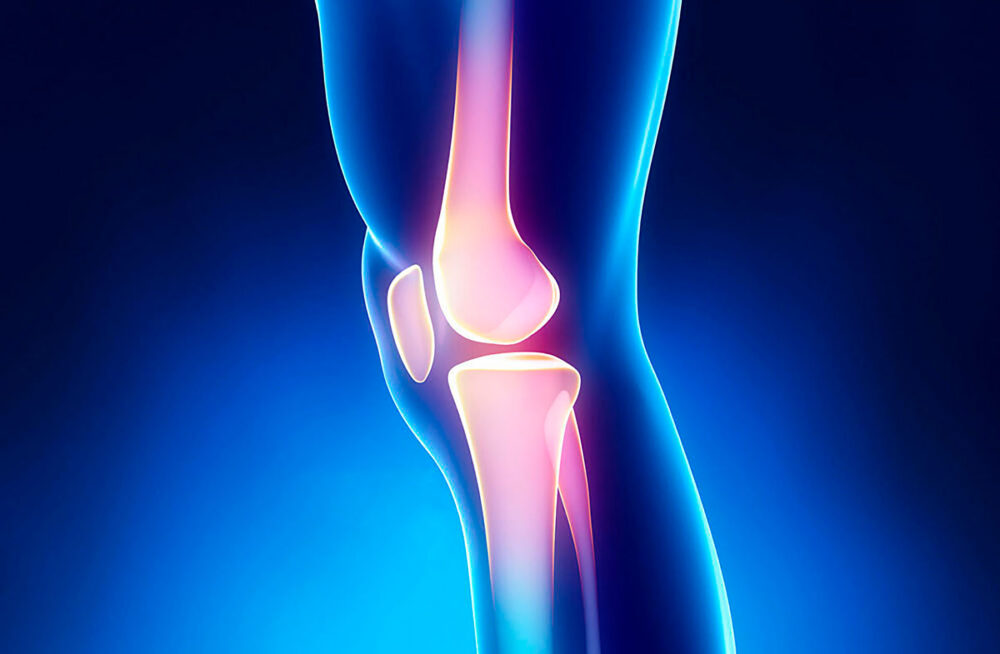 Especialista en Rodilla